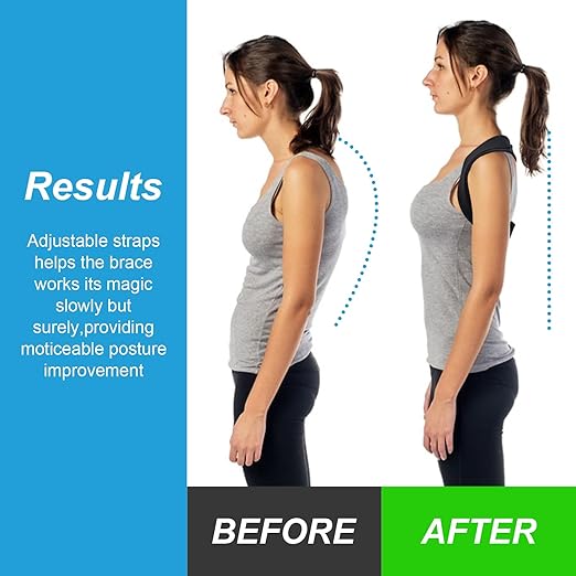 Adjustable Posture Corrector for Women & Men, Back Brace Posture Corrector and Upper Back Shoulder Brace, Back Straightener for Slouching & Neck Hump, Discreet Under Clothes, Breathable, Adjustable Size Fit