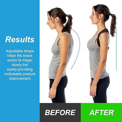 Adjustable Posture Corrector for Women & Men, Back Brace Posture Corrector and Upper Back Shoulder Brace, Back Straightener for Slouching & Neck Hump, Discreet Under Clothes, Breathable, Adjustable Size Fit