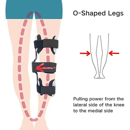 Kids O/X Legs Type Correction Brace, Pediatric Leg Posture Corrector, Children Legs Straightener for Knees Valgus Deformity Bow Leg, Leg Knee Orthosis Brace