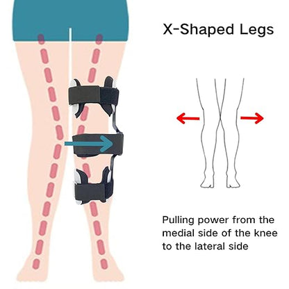Kids O/X Legs Type Correction Brace, Pediatric Leg Posture Corrector, Children Legs Straightener for Knees Valgus Deformity Bow Leg, Leg Knee Orthosis Brace