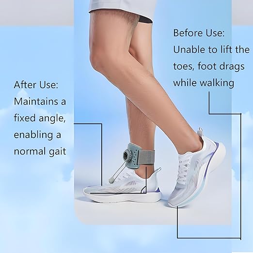 AFO Foot Drop Brace for Walking 2026 Upgraded - Soft Strap with Hard Shell, Reinforced Snap-Fit Lock, Support for Mild Foot Dragging, Tripping, Abnormal Posture,Gray