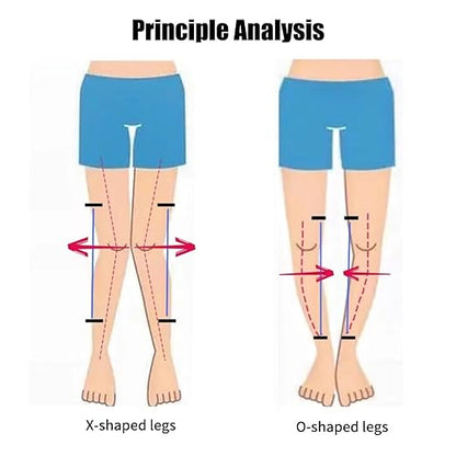 Kids O/X Legs Type Correction Brace, Pediatric Leg Posture Corrector, Children Legs Straightener for Knees Valgus Deformity Bow Leg, Leg Knee Orthosis Brace