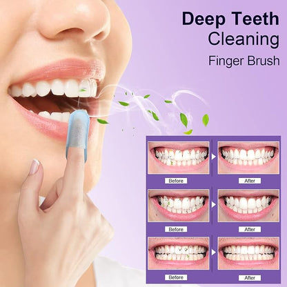 MySmile Teeth Wipes 100pcs Disposal Finger Brush Deep Cleaning Wipes Oral Brush Ups Tooth Wipes For Teeth Cleaning, Oral Freshes Mint Flavor