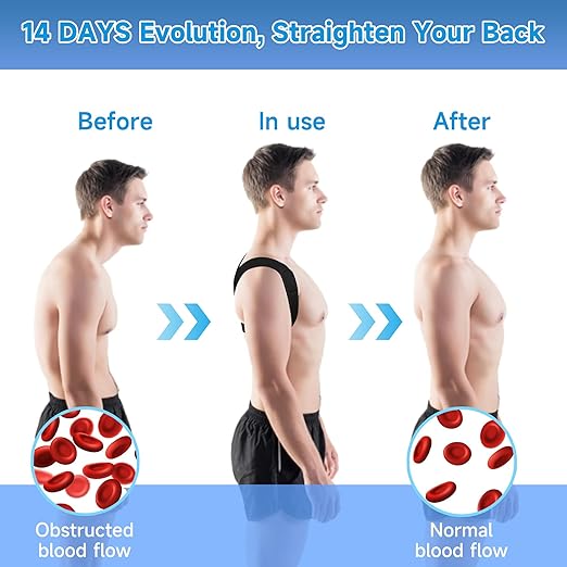 Posture Corrector for Women and Men, Adjustable Shoulder Brace Back Support for Men, Upper Back Brace for Women, Shoulder Straightener Neck Posture Corrector, Black M