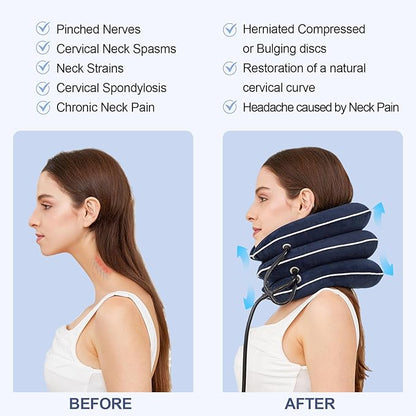 Neck Stretcher for Pain Relief, Adjustable Inflatable Cervical Traction Device, Neck Brace for Home Use, Supports Neck Decompression & Spine Alignment，Gifts for Women (Sky Blue)