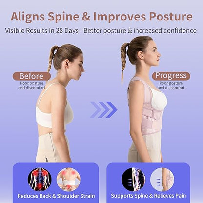 Posture Corrector for Women – 2-in-1 Back Brace with Shoulder Support, Adjustable Full Back Straightener for Upper & Lower Back Pain Relief, Hunchback, Scoliosis & Spine Alignment (L/XL)