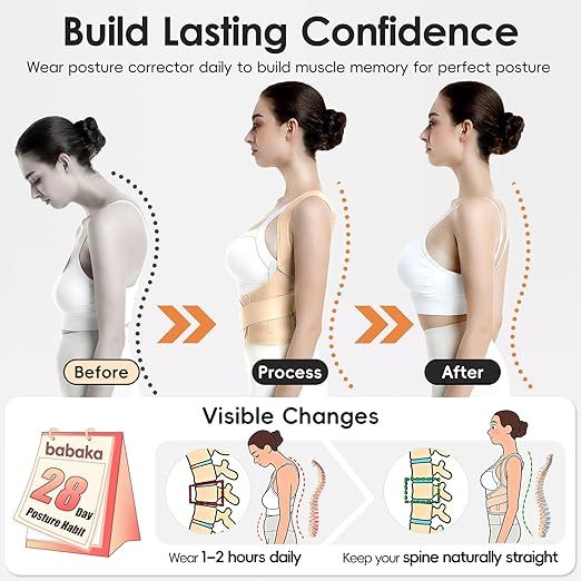 babaka Posture Corrector for Women, Invisible Lightweight Adjustable Back Brace for Upper and Lower Back Pain Relief, Hunchback, Hump, Scoliosis, Thoracic, Spine Corrector Under Clothes (Beige, Medium, Waist: 29''-35'')