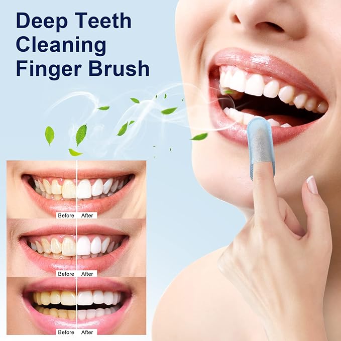 MySmile 100pcs Teeth Wipes Disposal Finger Brush Deep Cleaning Teeth Wipes Oral Brush Up Tooth Wipes for Teeth Cleaning, Mint Flavor