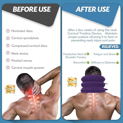 Neck Stretcher, Neck Traction Device, Neck Pain Relief, Adjustable Inflatable Neck Brace & Neck Stretcher Cervical Traction, Neck Decompression Home Use