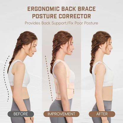 Back Brace Posture Corrector for Women & Men, Adjustable Shoulder Straightener with Full Back Support, Relief for Lower & Upper Back Pain, Hunchback & Scoliosis (Beige, Small) | Back Braces - TrueDesk